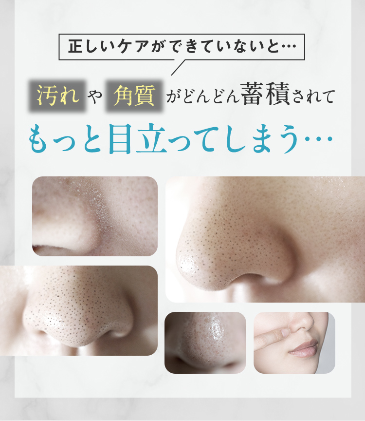 正しいケアができていないと… 汚れや角質がどんどん蓄積されてもっと目立ってしまう…
