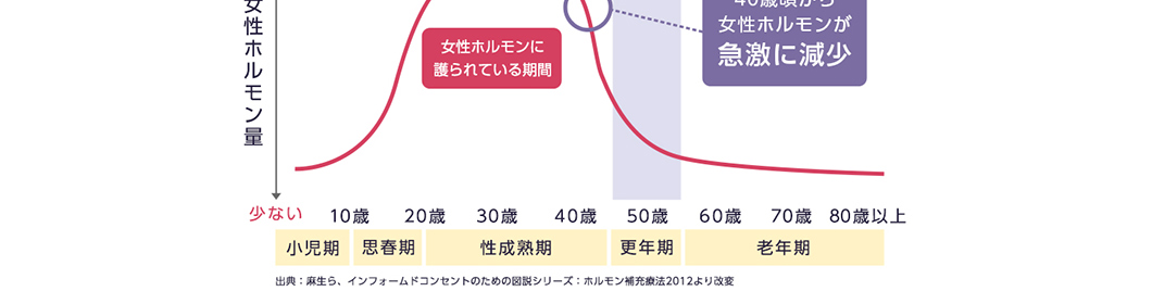 表