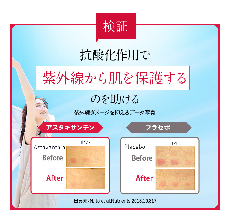 抗酸化作用で紫外線から肌を保護するのを助ける