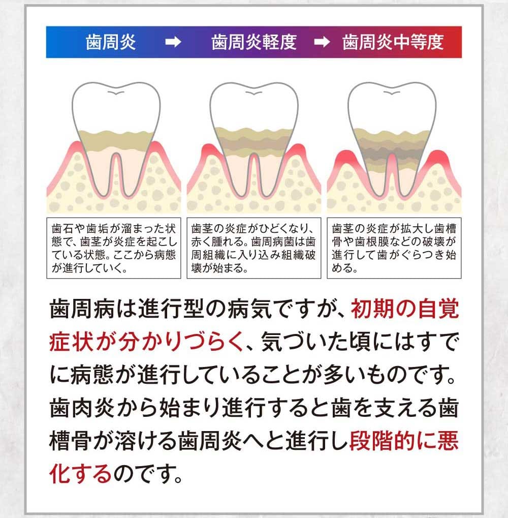 進行度イラスト