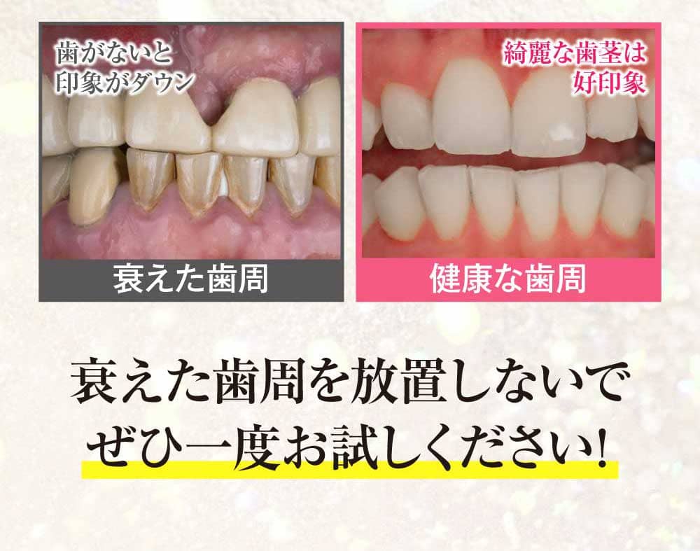 衰えた歯周を放置しないで