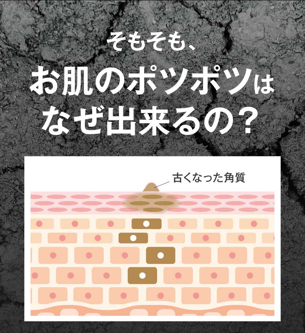 そもそも、なぜ？イボが出来るの？
