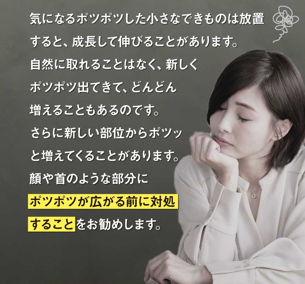 イボは成長して伸びます。
