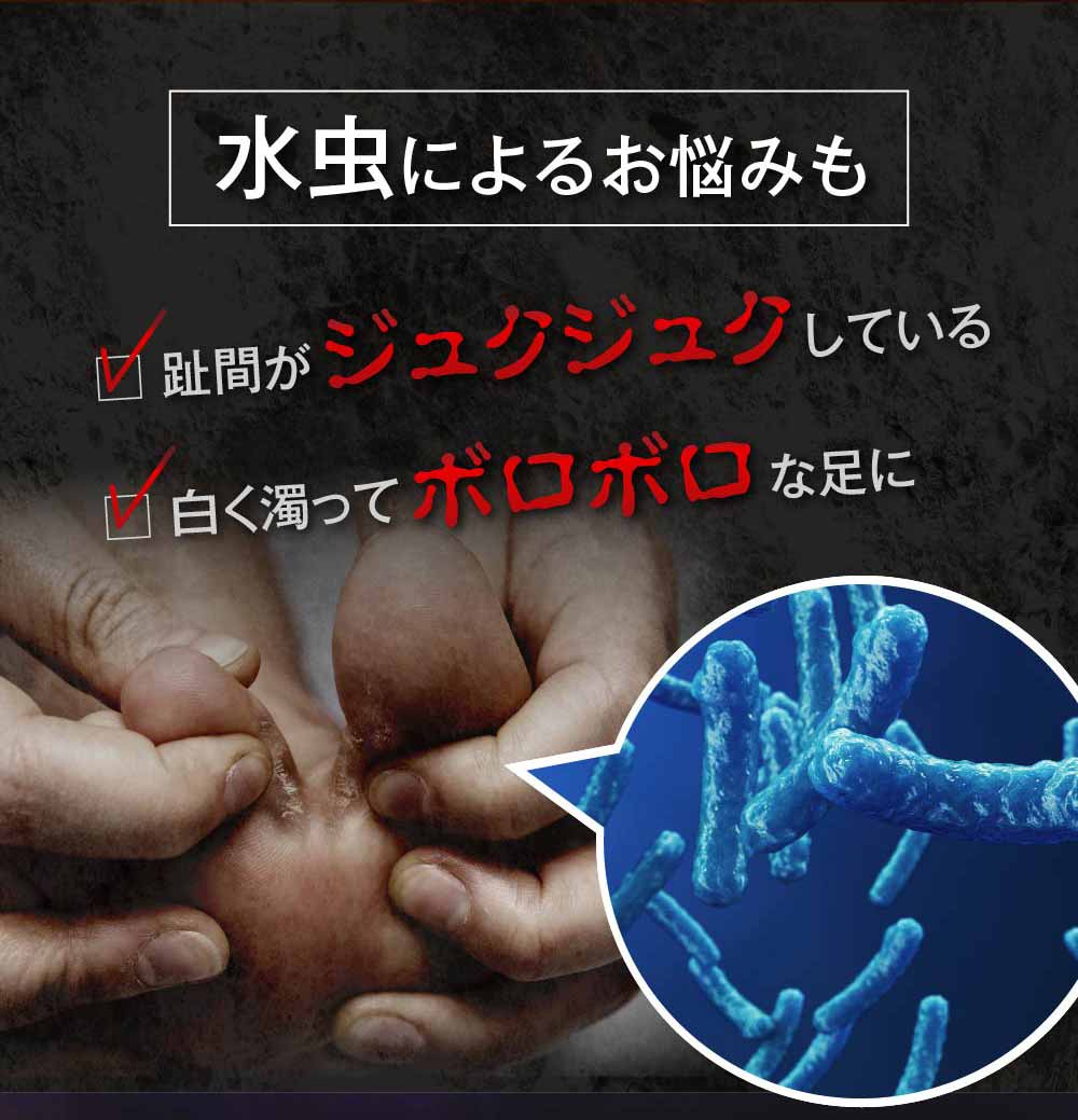 しつこい水虫に、第二医薬品のクリーム状の商品が登場！