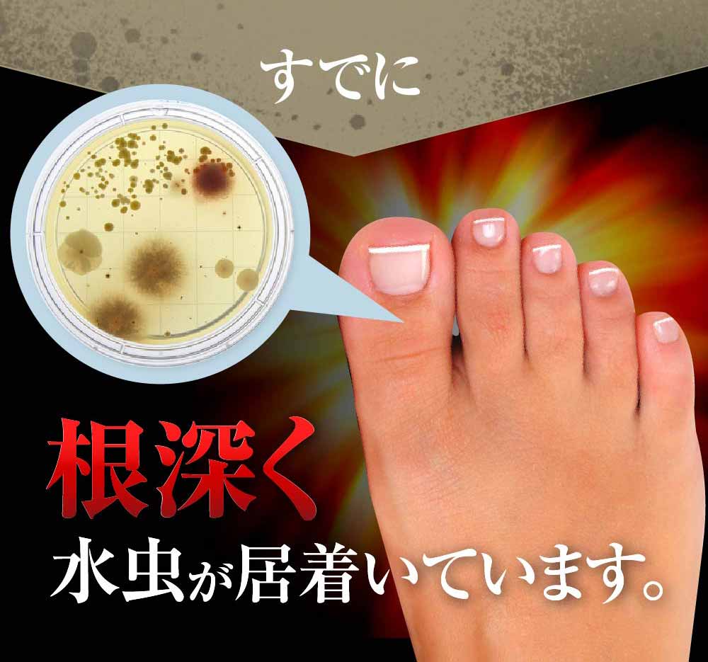 根深く水虫が居着いています