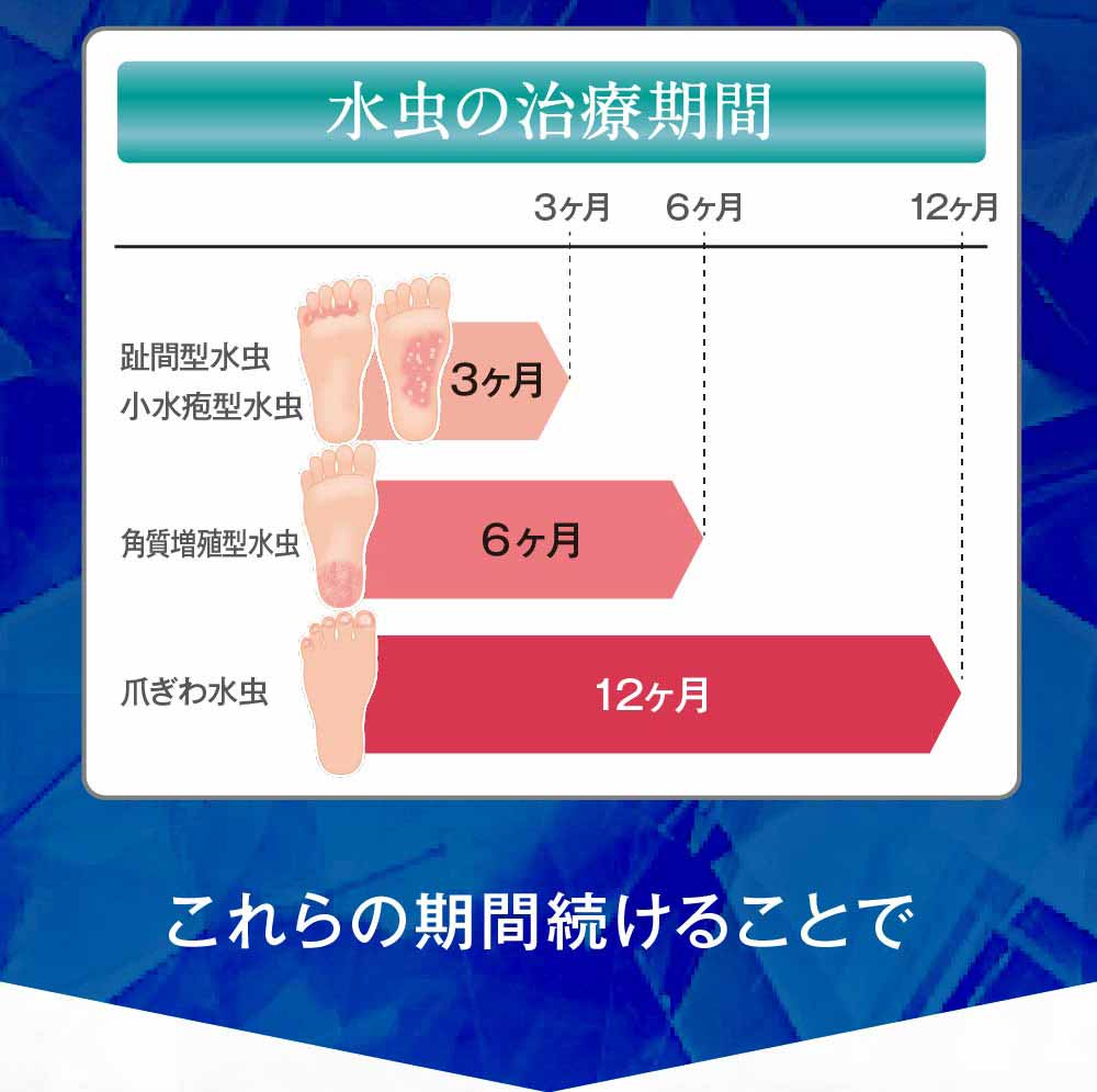 水虫の治療期間は症状によって異なるので適切に治療をしましょう