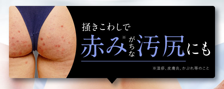 掻き壊しで黒ずみがちな汚尻も｜ポテンツァクリーム ビシリッチ