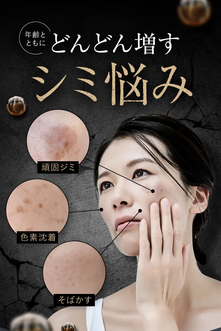 シミ悩み