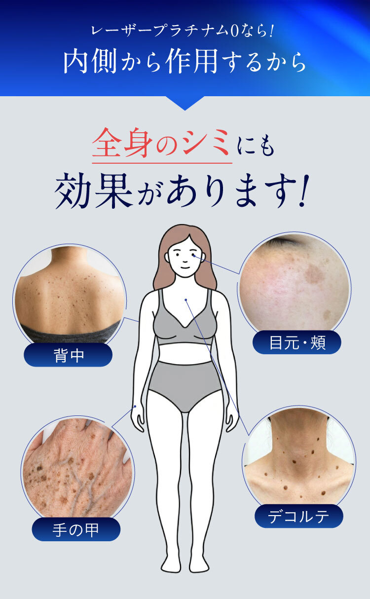 全身のシミにも効果があります