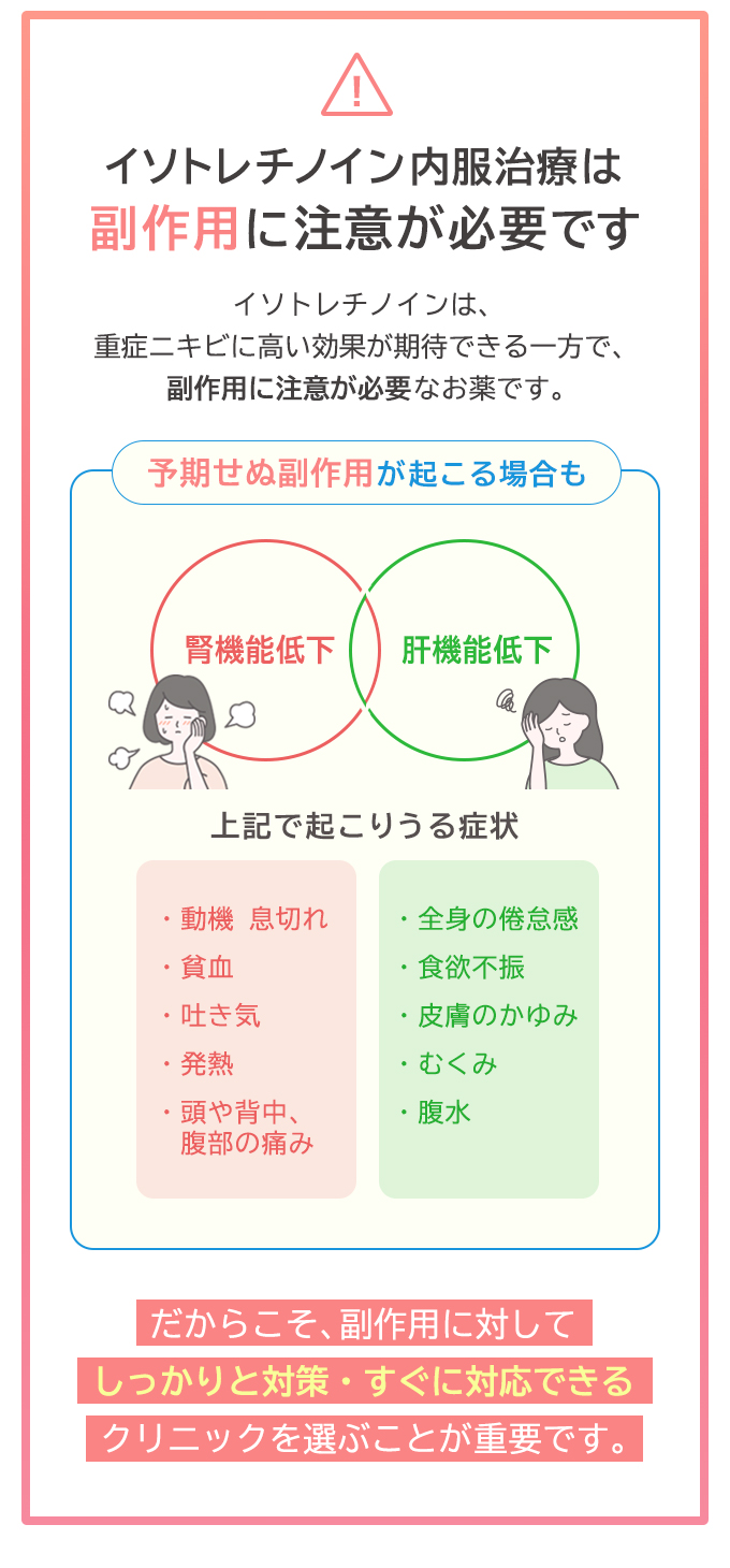 イソトレチノイン内服治療は副作用に注意が必要