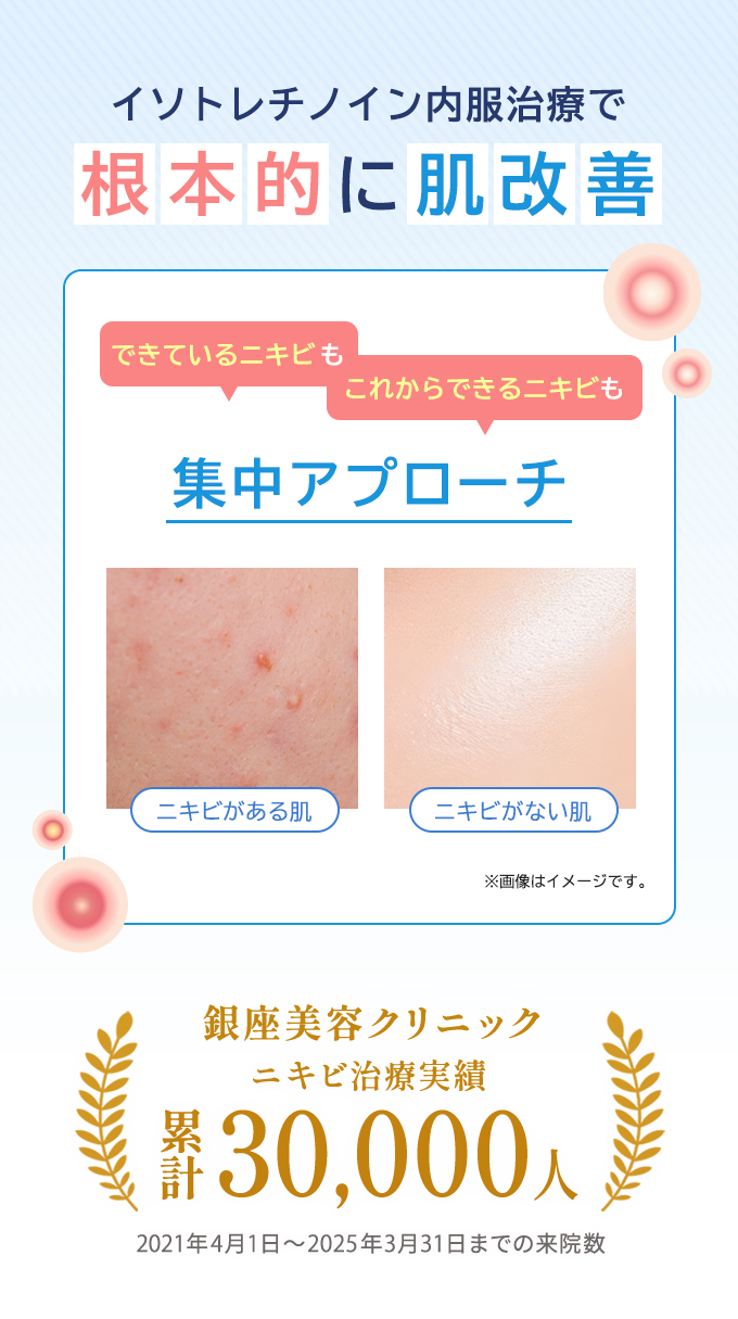 当院のニキビ治療実績は累計30,000人