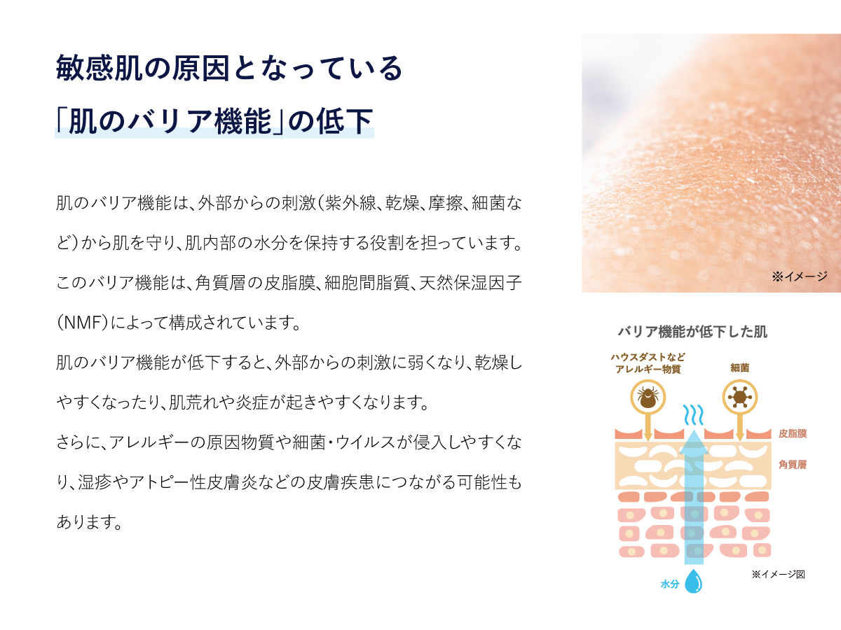 敏感肌の原因
