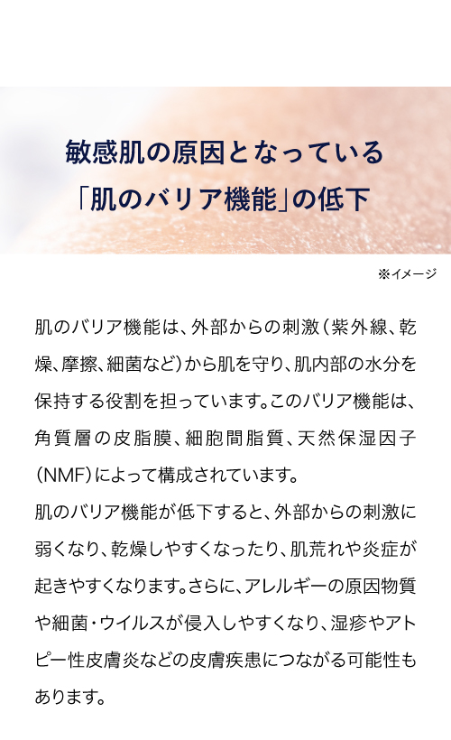 敏感肌の原因