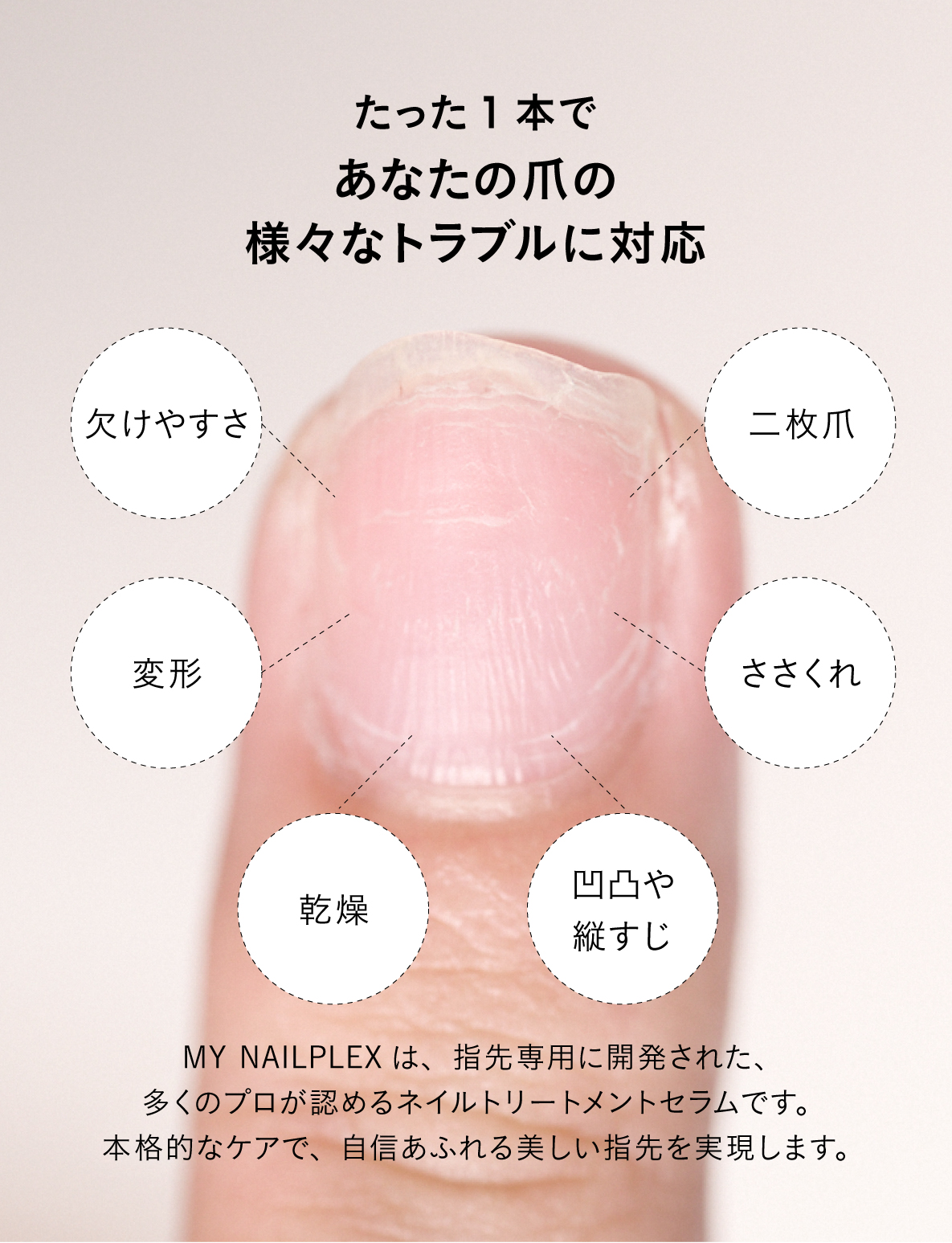 MY NAILPLEX – Gift Edition