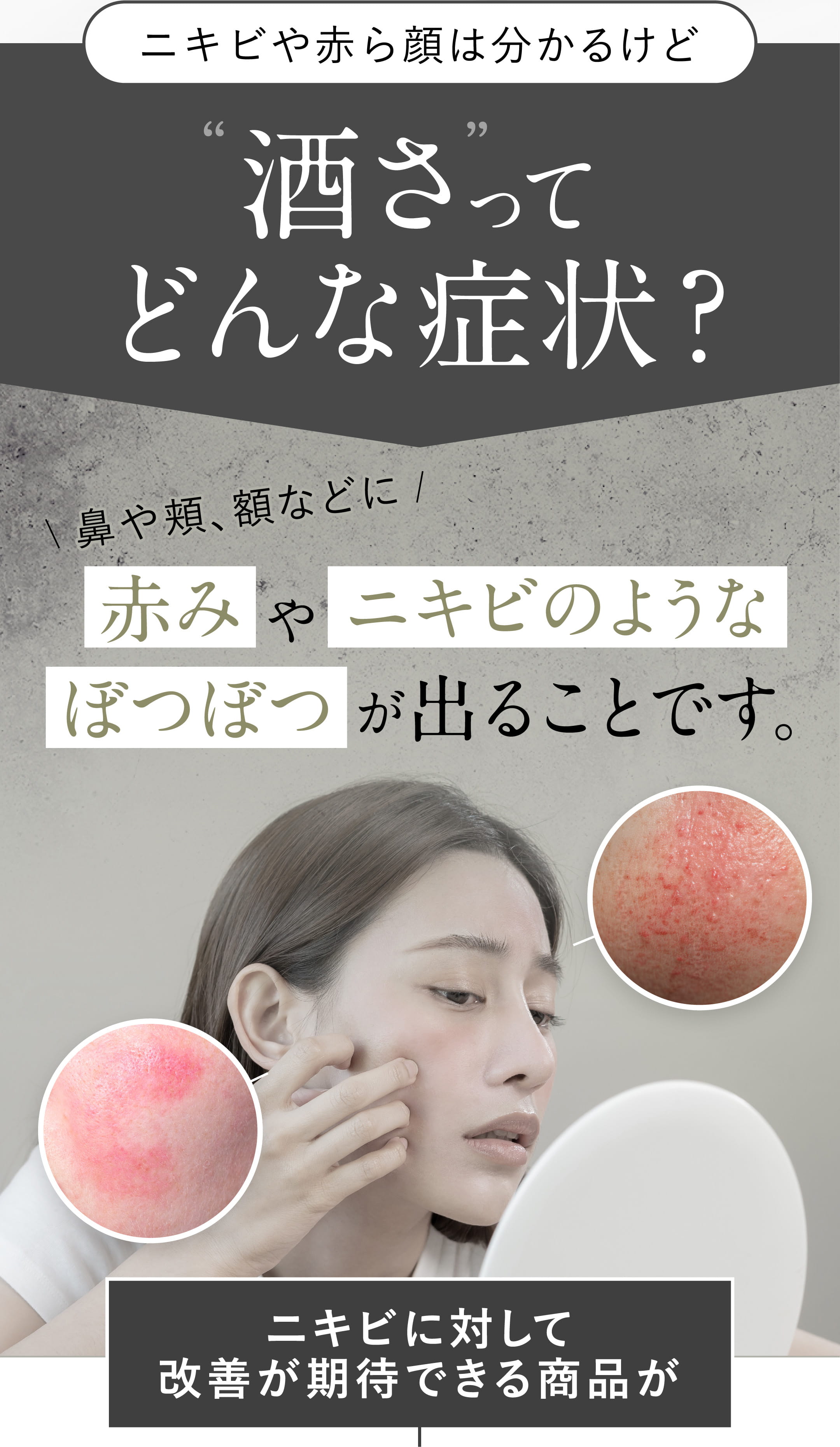 ニキビや赤ら顔は分かるけど酒さってどんな症状?