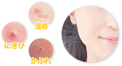 湿疹・にきび・かぶれ