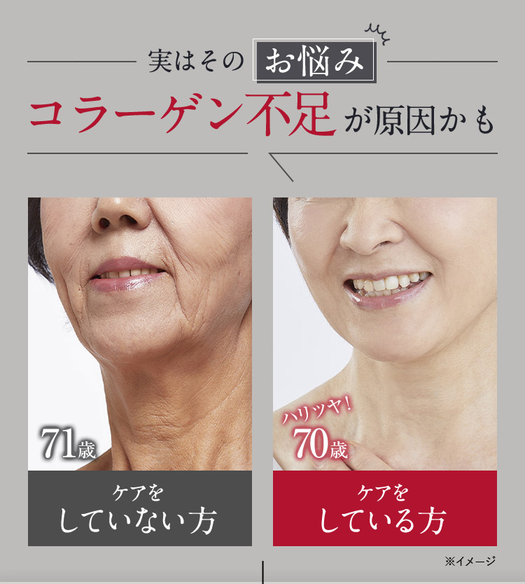 実はそのお悩み コラーゲン不足が原因かも 71歳 ケアをしていない方 ハリツヤ！70歳 ケアをしている方 ※イメージ