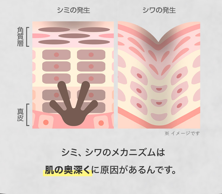 シミの発生 シワの発生 ※イメージです シミ、シワのメカニズムは肌の奥深くに原因があるんです。