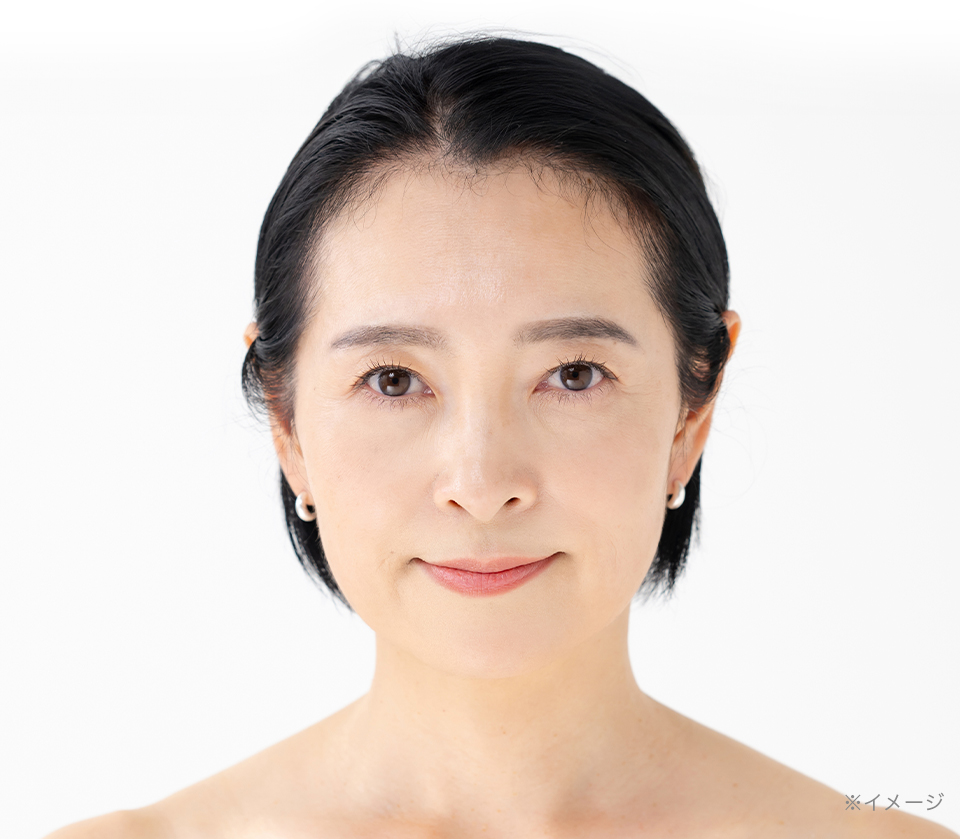 アフター画像