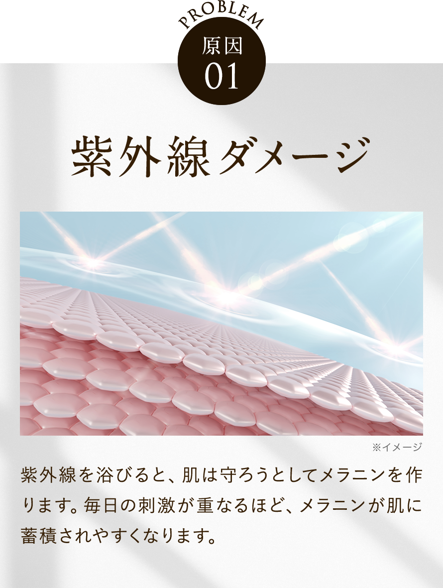 紫外線ダメージ