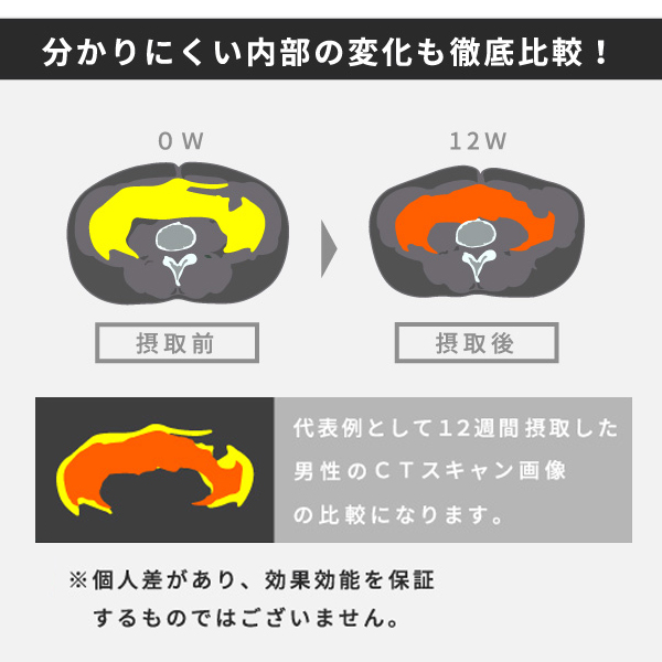 お腹の脂肪に黒しょうが［3袋定期コース］
