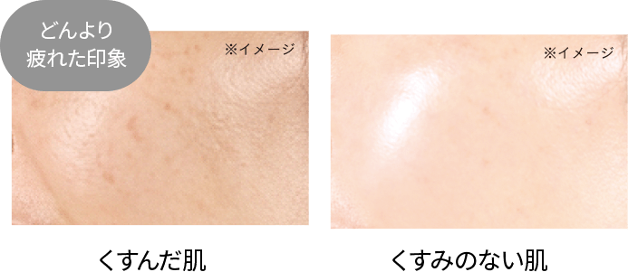 くすんだ肌 くすみのない肌 比較