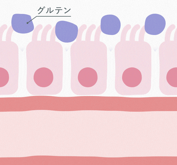 グルテンが腸に溜まるイメージ
