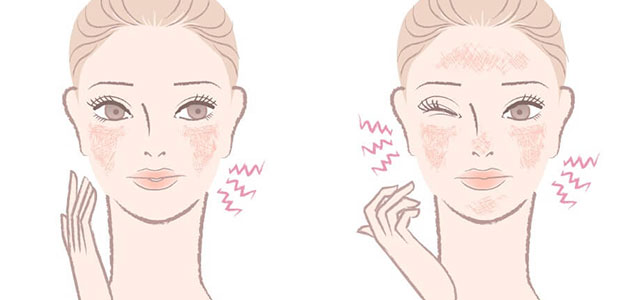 肌質「敏感肌」とは