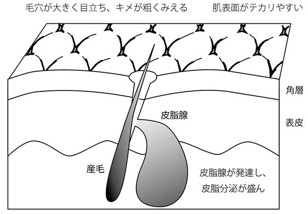 脂性肌の肌モデル図