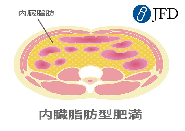 そもそも「肥満症」の定義とは？