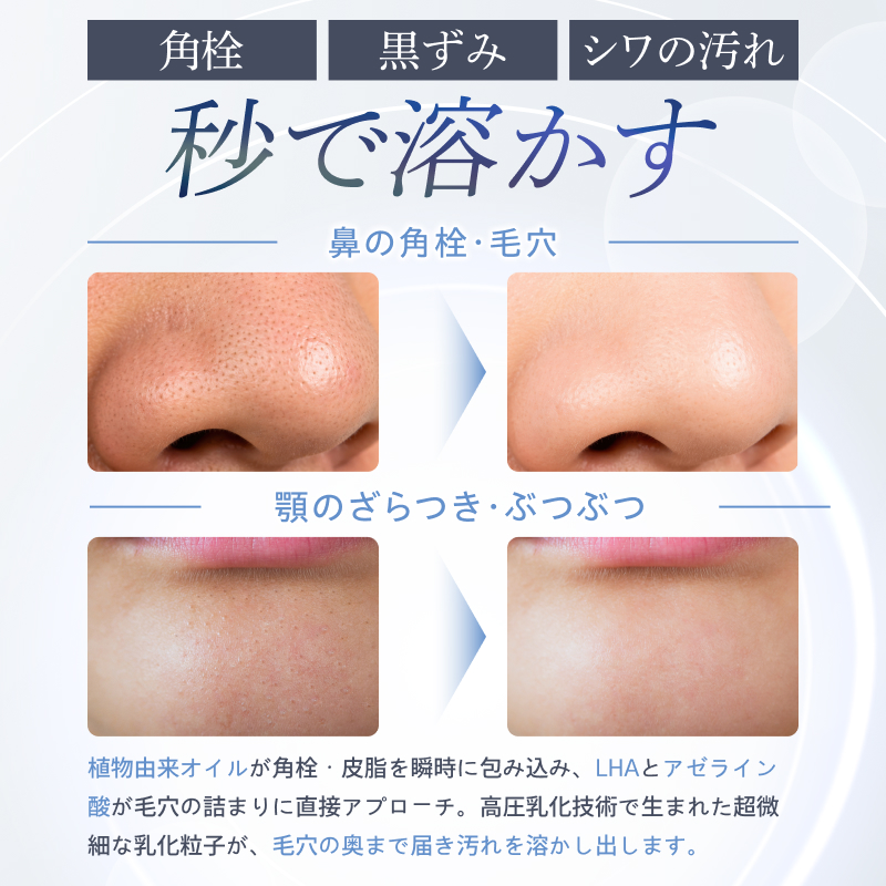 アカラン VCリペアクレンジングオイル 115ml