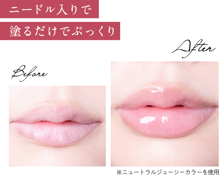 ニードル入りで塗るだけでぷっくり