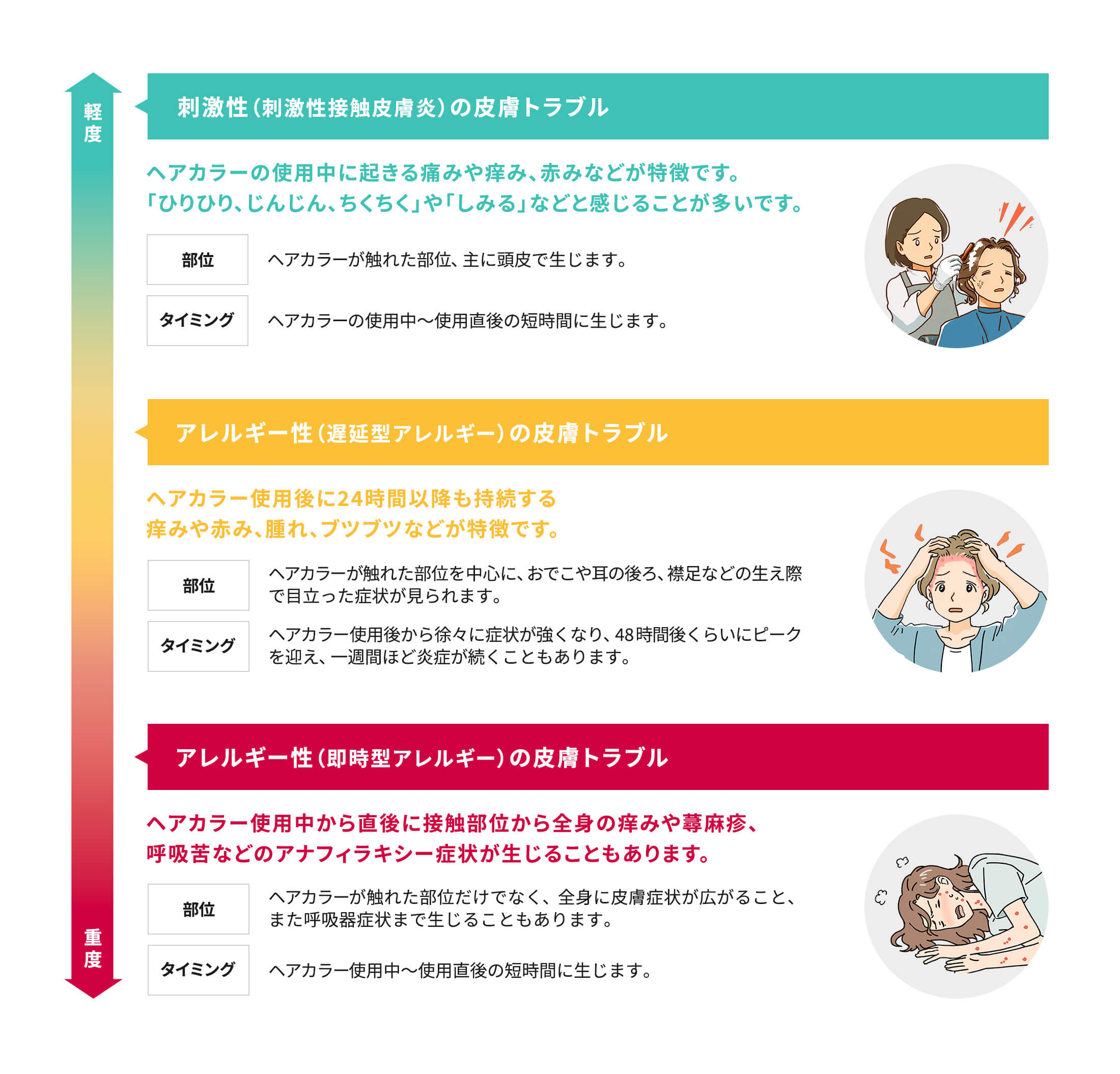 刺激性（一次刺激性接触皮膚炎）の皮膚トラブル アレルギー性（遅延型アレルギー）の皮膚トラブル アレルギー性（即時型アレルギー）の皮膚トラブル