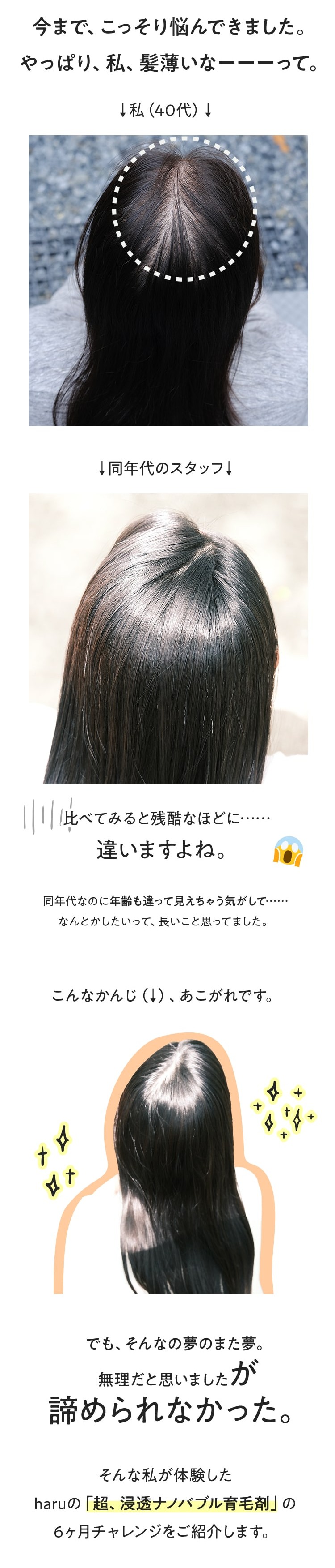 今まで、こっそり悩んできました。やっぱり、私、髪薄いなーーーーって。そんな私が体験したharuの「超、浸透ナノバブル育毛剤」の６ヶ月チャレンジをご紹介します。
