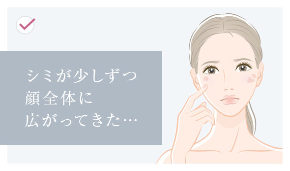 シミが少しずつ顔全体に広がってきた…