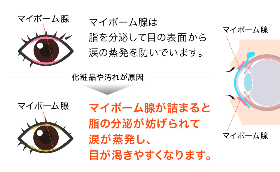 マイボーム腺の役割と化粧品・汚れによる詰まり・目のかわきのメカニズム図解