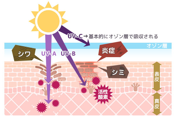 紫外線ダメージ