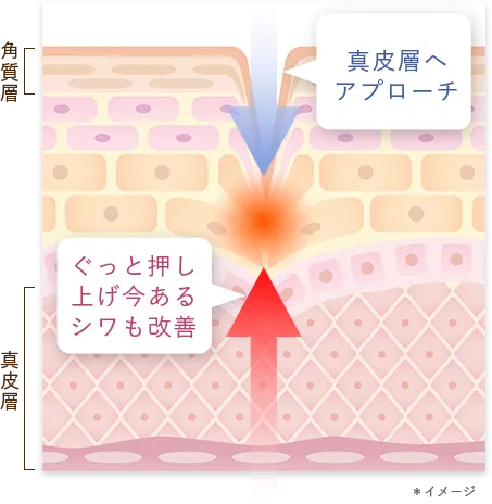 真皮層までアプローチし加齢による年齢ジワ改善 | キューサイ【公式】通販サイト