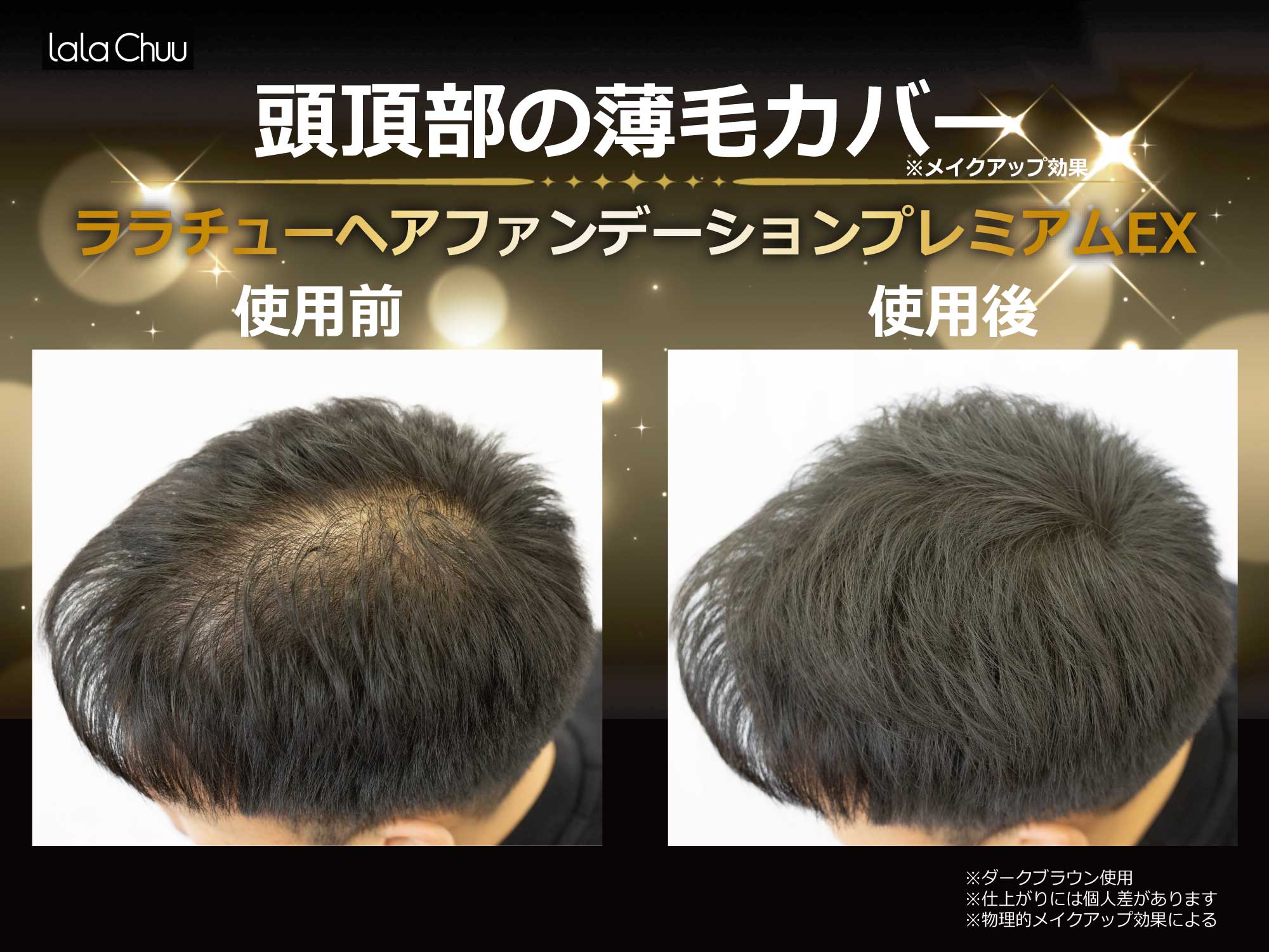 【lalachuu/ララチュー】プレミアムEXR ダークブラウン 本品