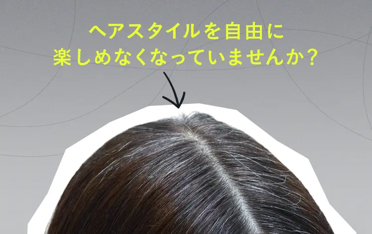 ヘアスタイルを自由に楽しめなくなっていませんか？