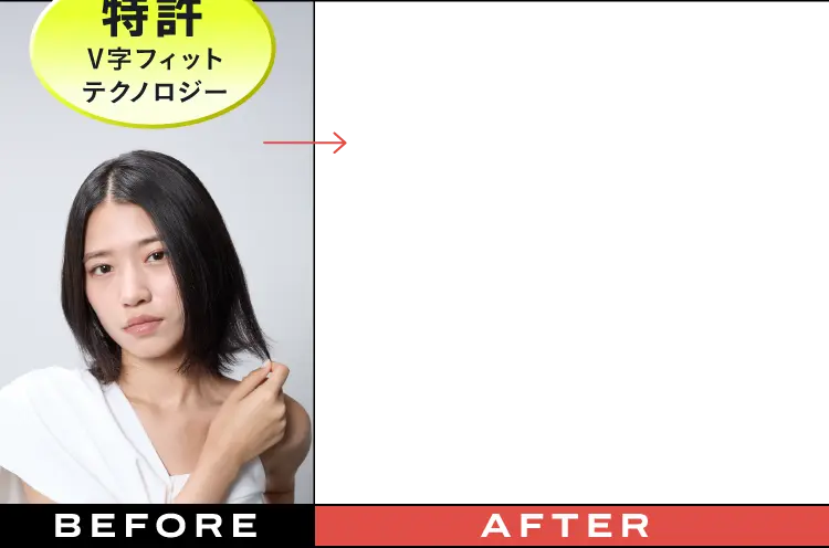 特許 V字フィットテクノロジー