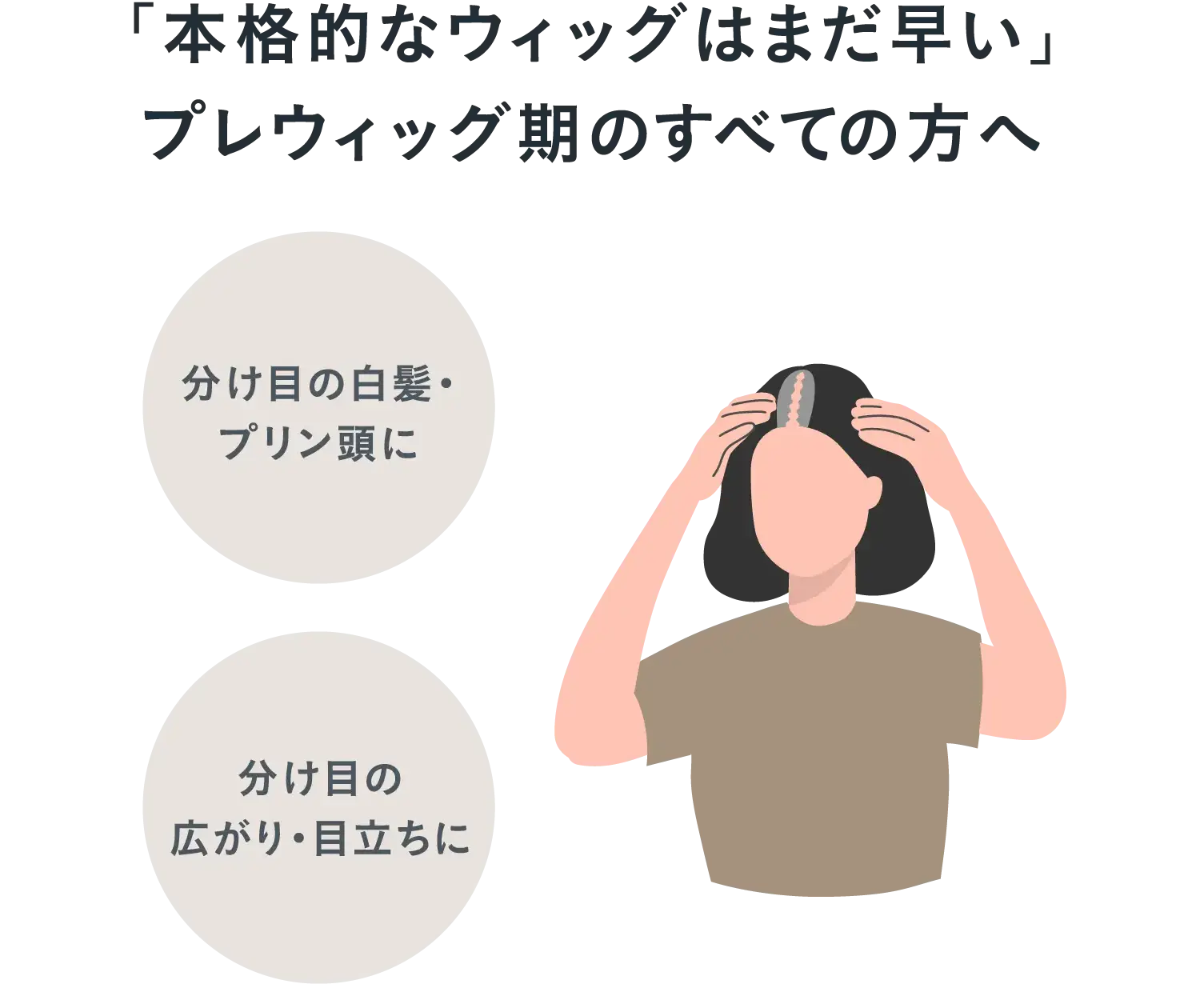 「本格的なウィッグはまだ早い」プレウィッグ期のすべての方へ