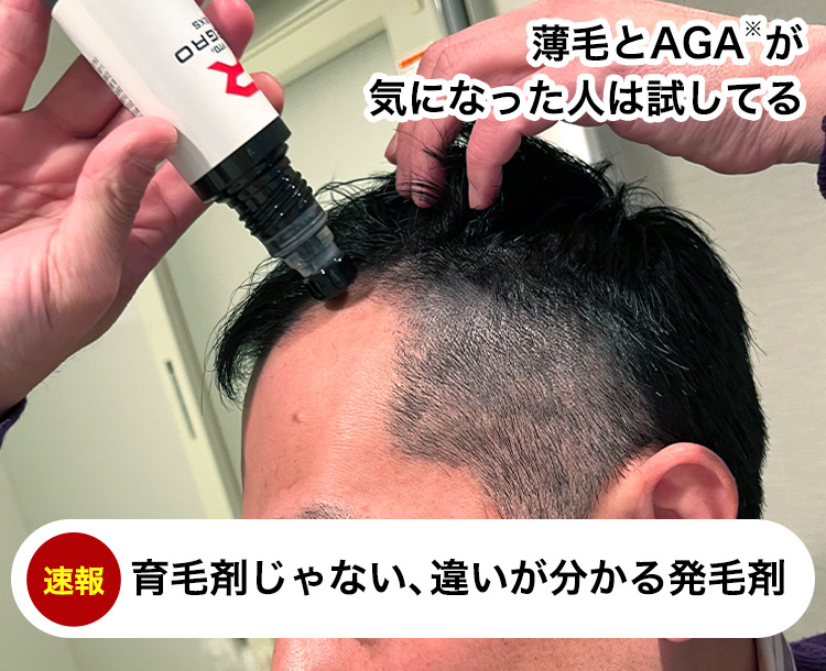 薄毛とAGAが気になった人は試してる 速報 育毛剤じゃない、違いが分かる発毛剤