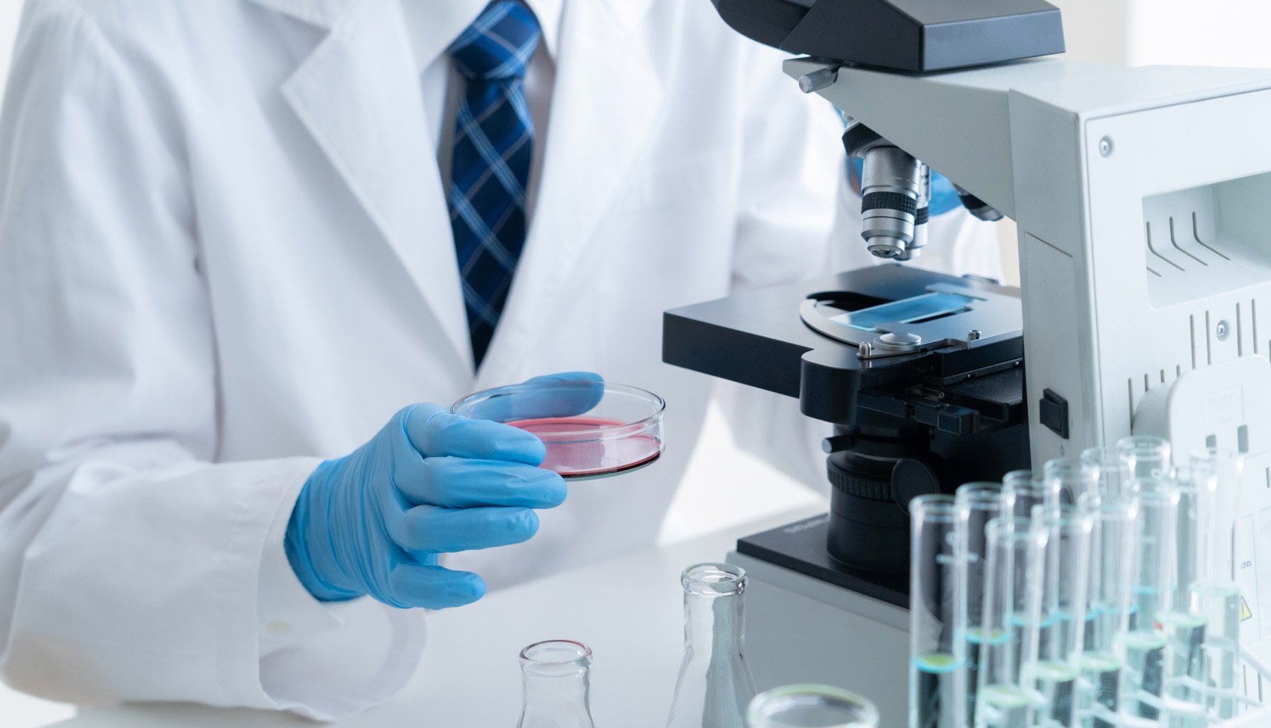 ストレピアの強み