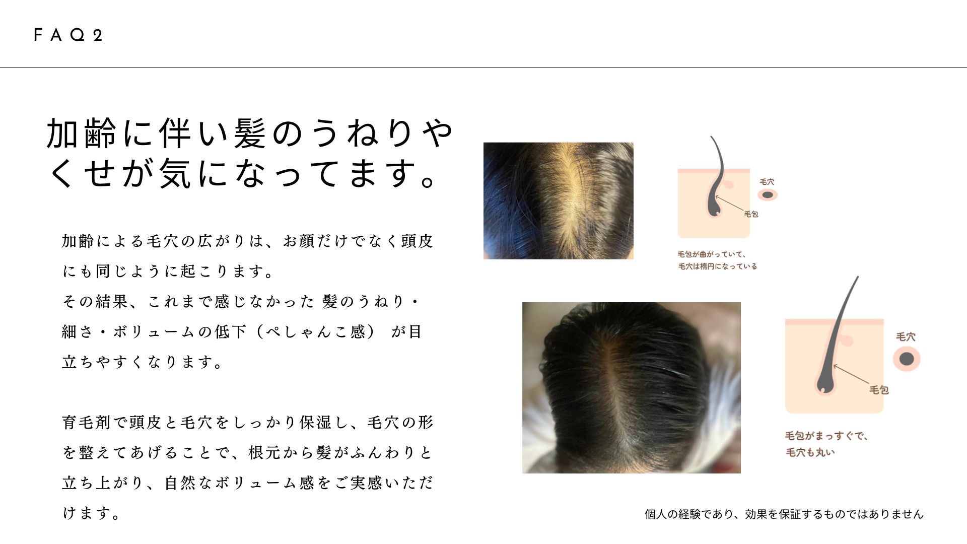 メディケイティド スカルプエッセンス