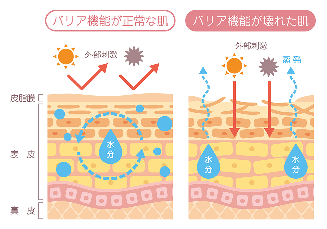 健康な肌とバリア機能が乱れた肌