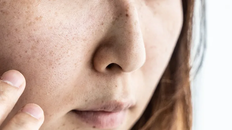 50代特有の肌悩み