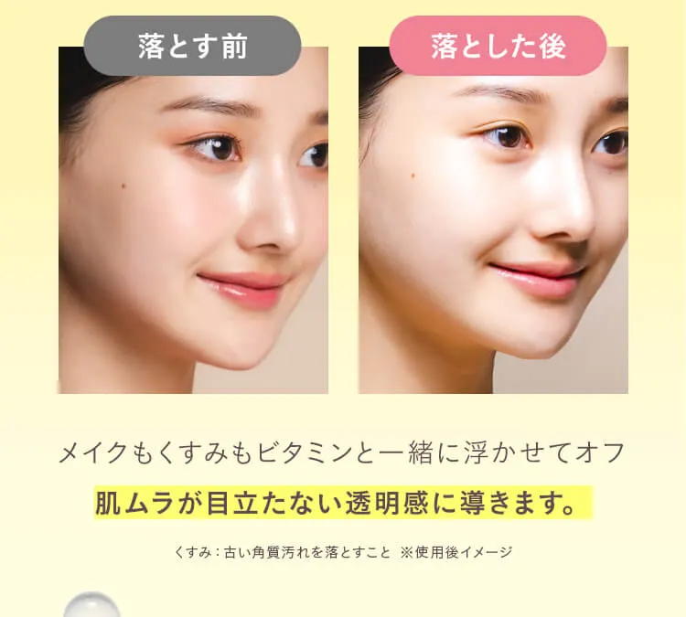 ビフォアフ
